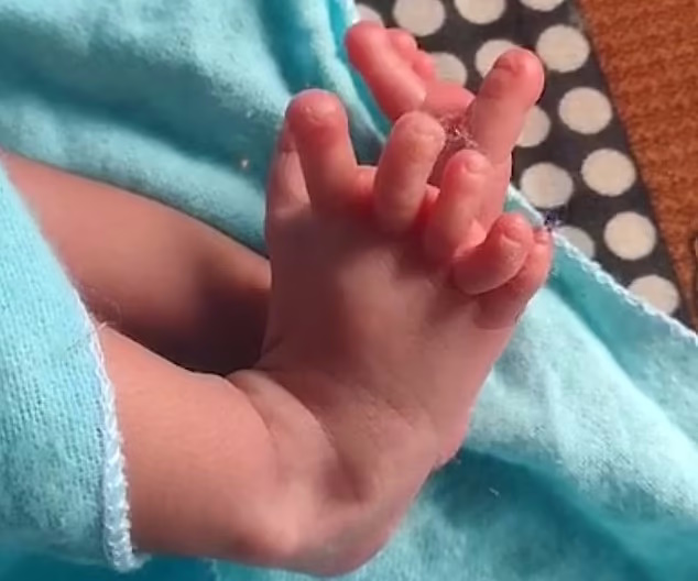 مورد عجیب نوزادی با ۲۶ انگشت که خانواده اش او را تناسخ الهه هندو می‌دانند