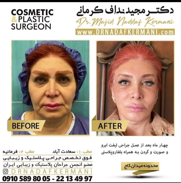 فوق تخصص جراحی پلاستیک و زیبایی در تهران - دکتر مجید نداف کرمانی